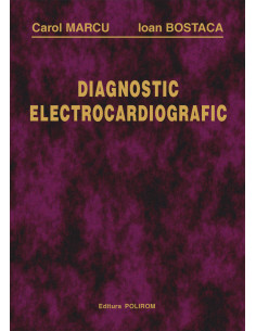 Diagnostic electrocardiografic