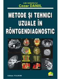 Metode şi tehnici uzuale în...