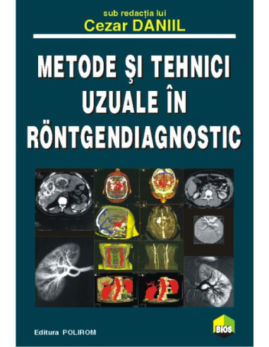 Metode și tehnici uzuale în röntgendiagnostic