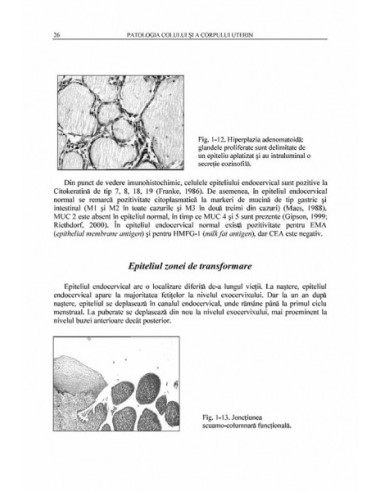 Patologia colului şi a corpului uterin