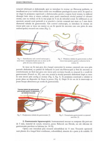 Tehnici chirurgicale