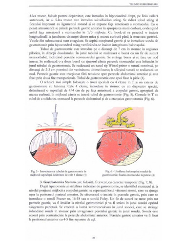 Tehnici chirurgicale