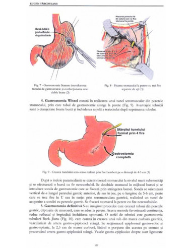 Tehnici chirurgicale