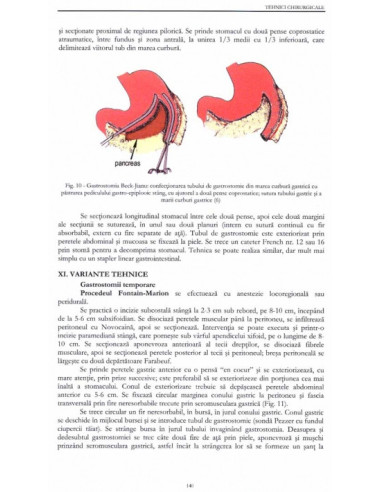 Tehnici chirurgicale