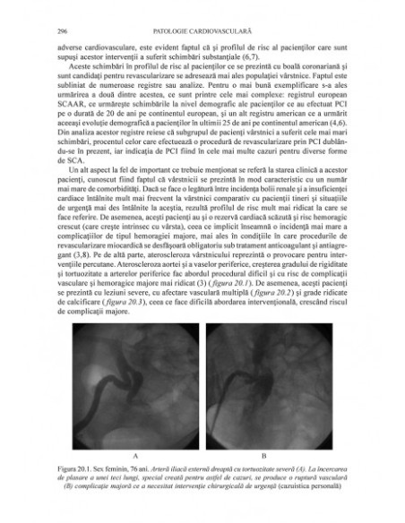 Bolile cardiovasculare la vârstnici
