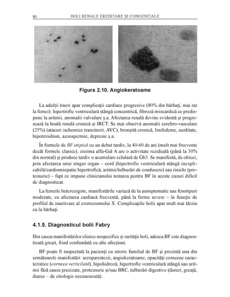 Boli renale ereditare și congenitale